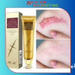 Acne Scar Removal Cream Pimples Stretch Marks Face Gel Remove Acne Smoothing Whitening Moisturizing Body Face Skin Care